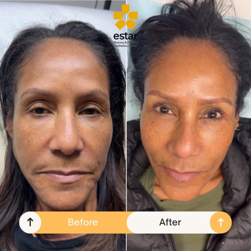 facial-balancing-8