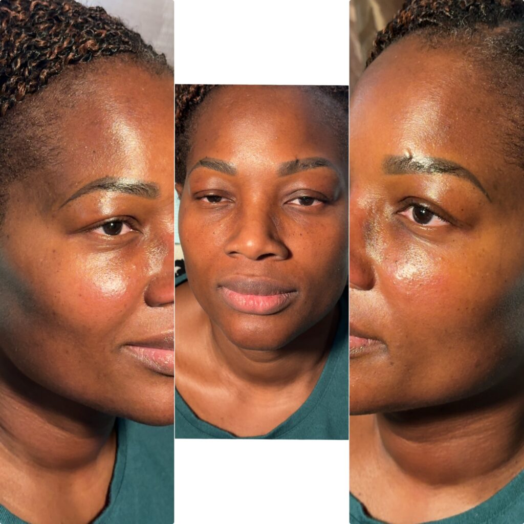 facial-balancing-9