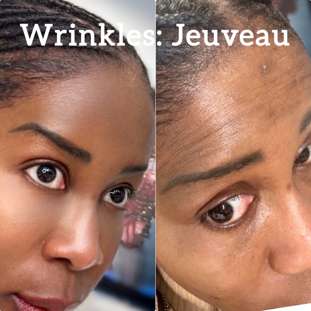 jeuveau
