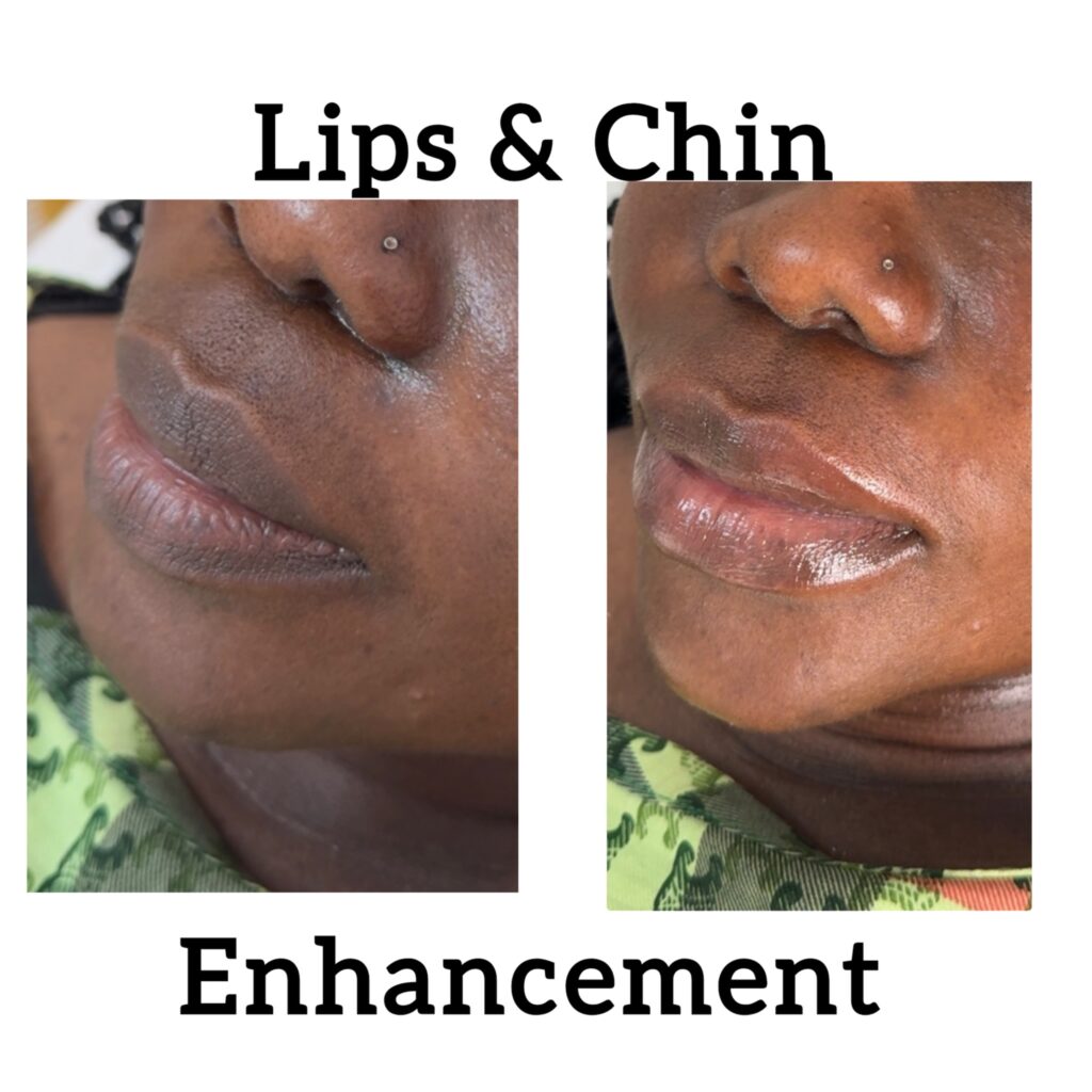 lips-chin