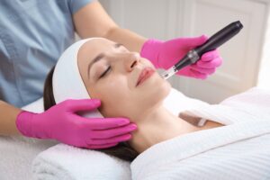 woman undergoing microneedling between sessions