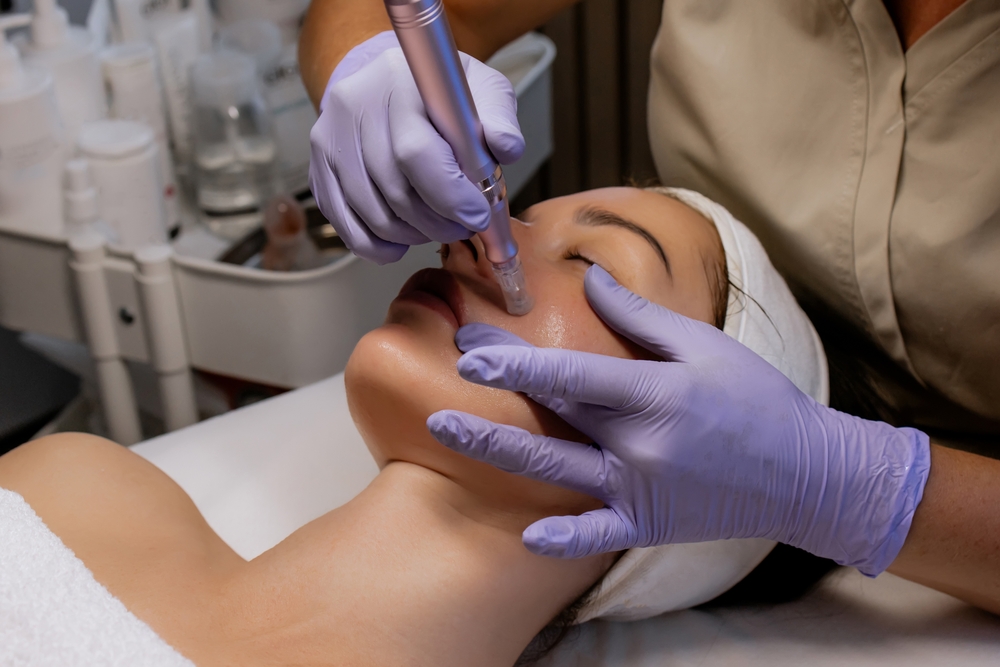 woman getting microneedling treatments in Olney