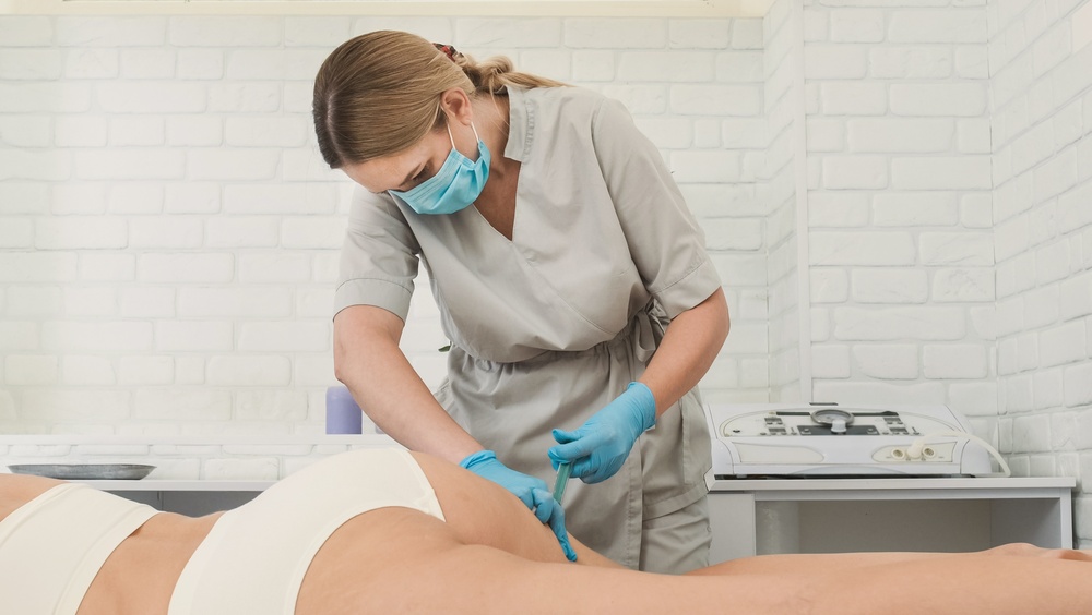 non-surgical treatment for cellulite in Olney