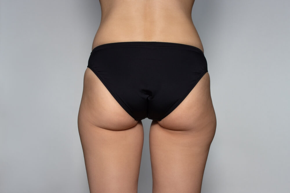 Non-Surgical Treatments for Hip Dips in Olney