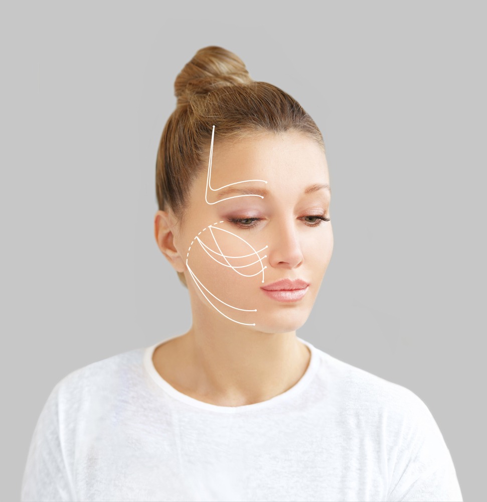 Non-Surgical Facelift