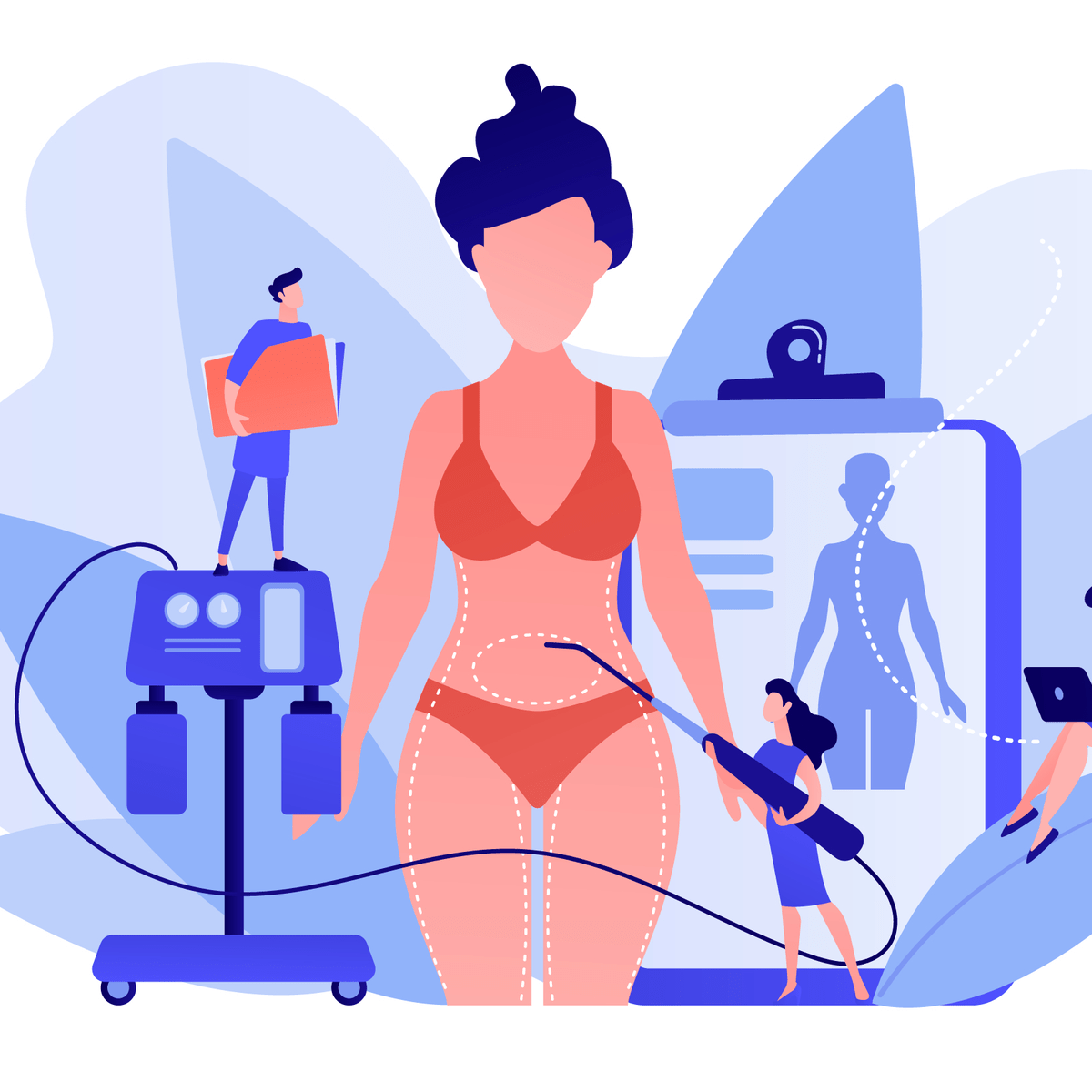 Liposuction in Montgomery County – How Long Does It Last?