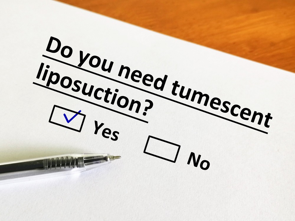 Tumescent Liposuction in Silver Spring
