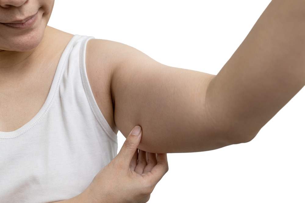 Where Can I Get the Best Under-Arm Liposuction in the DMV?